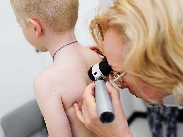 Dermatologie Pédiatrique Fès
