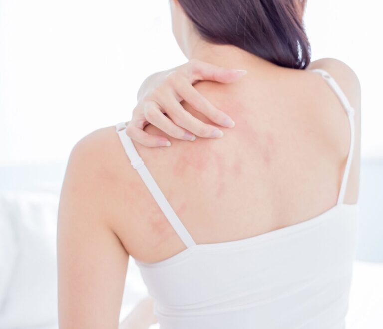 Dérmatologue Allergologie Cutanée Fès